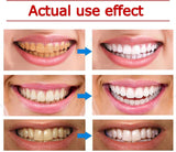 SP4 Toothpaste Ultra Whitening Toothpaste SP-4 Probiotics Whitening Toothpaste